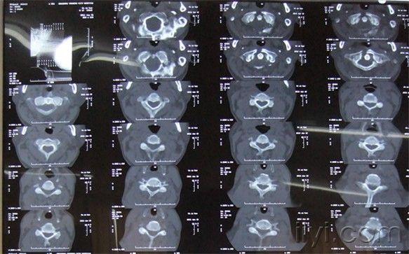 亲们 最新骨颈骨折吧,亲们，最新骨颈骨折不要慌，大自然的美景等你探索！